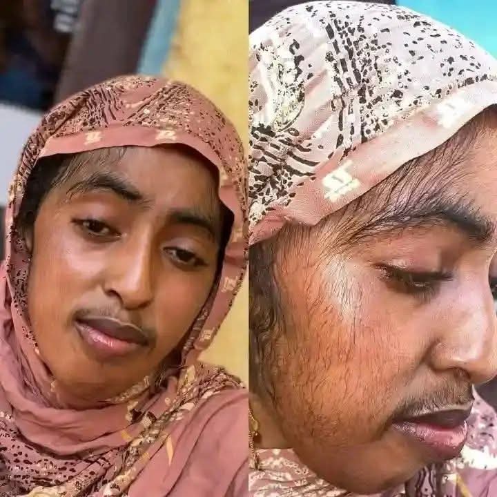 مأساة شابة .. تواجه ظاهرة غريبة وتطلق نداء عاجلا مأساة شابة .. تواجه ظاهرة غريبة وتطلق نداء عاجلا