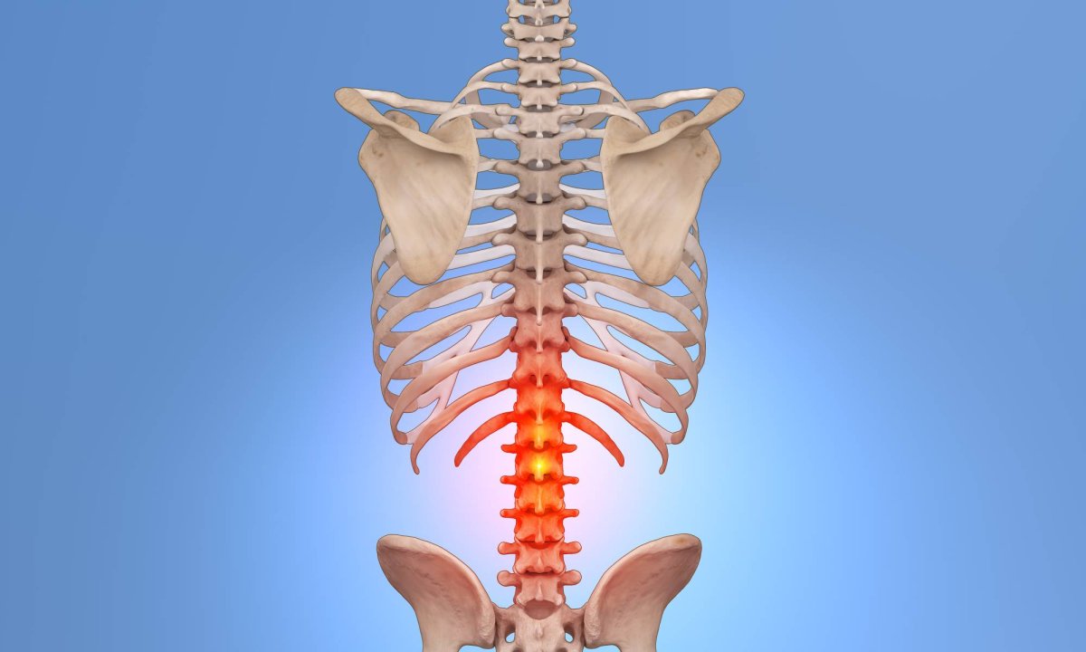 الانزلاق الغضروفي: 10 معلومات حول التعامل الطبي مع حالاته