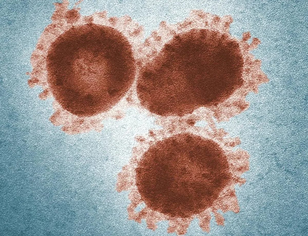 وفاة شخصين وإصابات خطيرة بالسحايا في بريطانيا... ماذا نعرف عن المرض